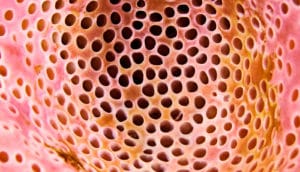 holes in a sponge (trypophobia concept)