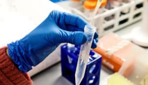 test tube in hand (HIV test concept)