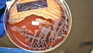 golden staph in petri dish (superbugs concept)