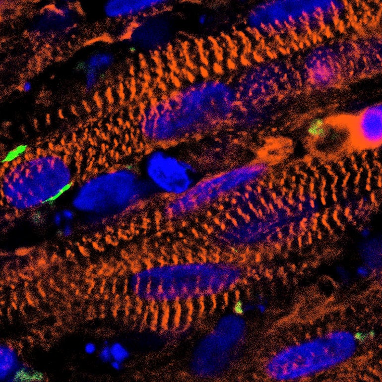 muscle cross section