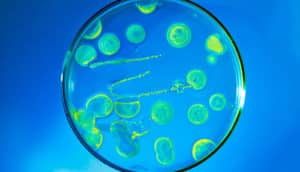 petri dish on blue background with green bacteria (antibiotics concept)