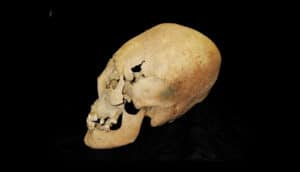 female elongated skull