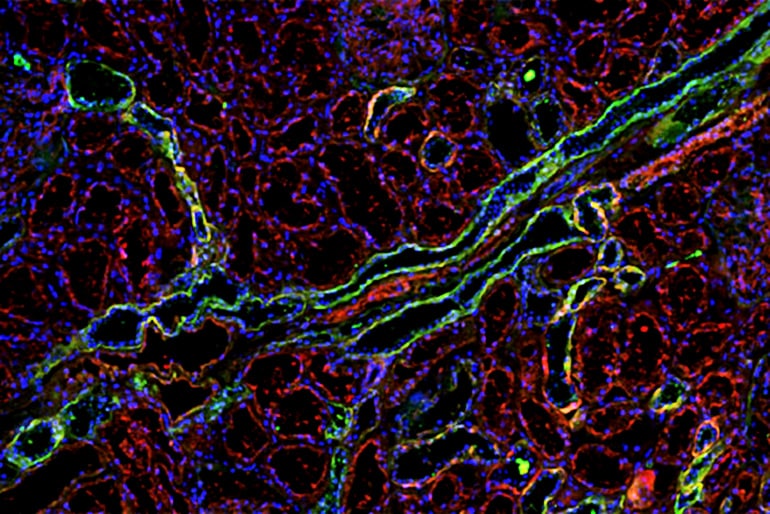 kidney tissue