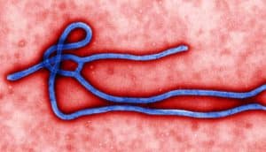 Ebola virus virion