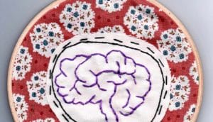 brain stitching