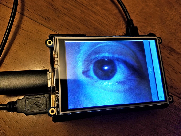 eye on screen medical device for doctors with disabilities