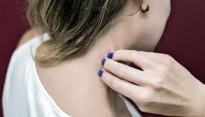 woman itching neck - chronic itching