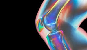 knee joint -- joint pain in obesity