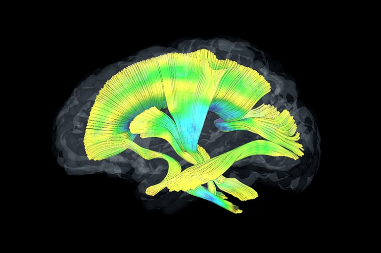 white matter fiber tracts