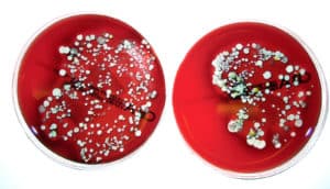 MRSA petri dishes