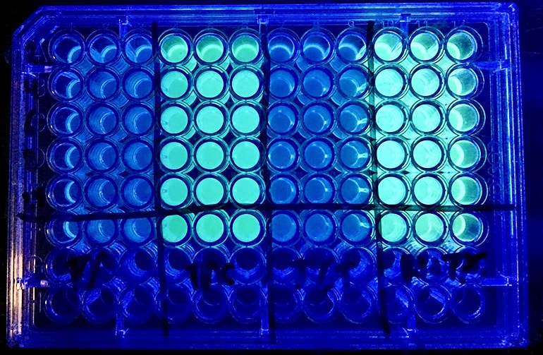 comparison of cystic fibrosis bacteria before and after treatment.