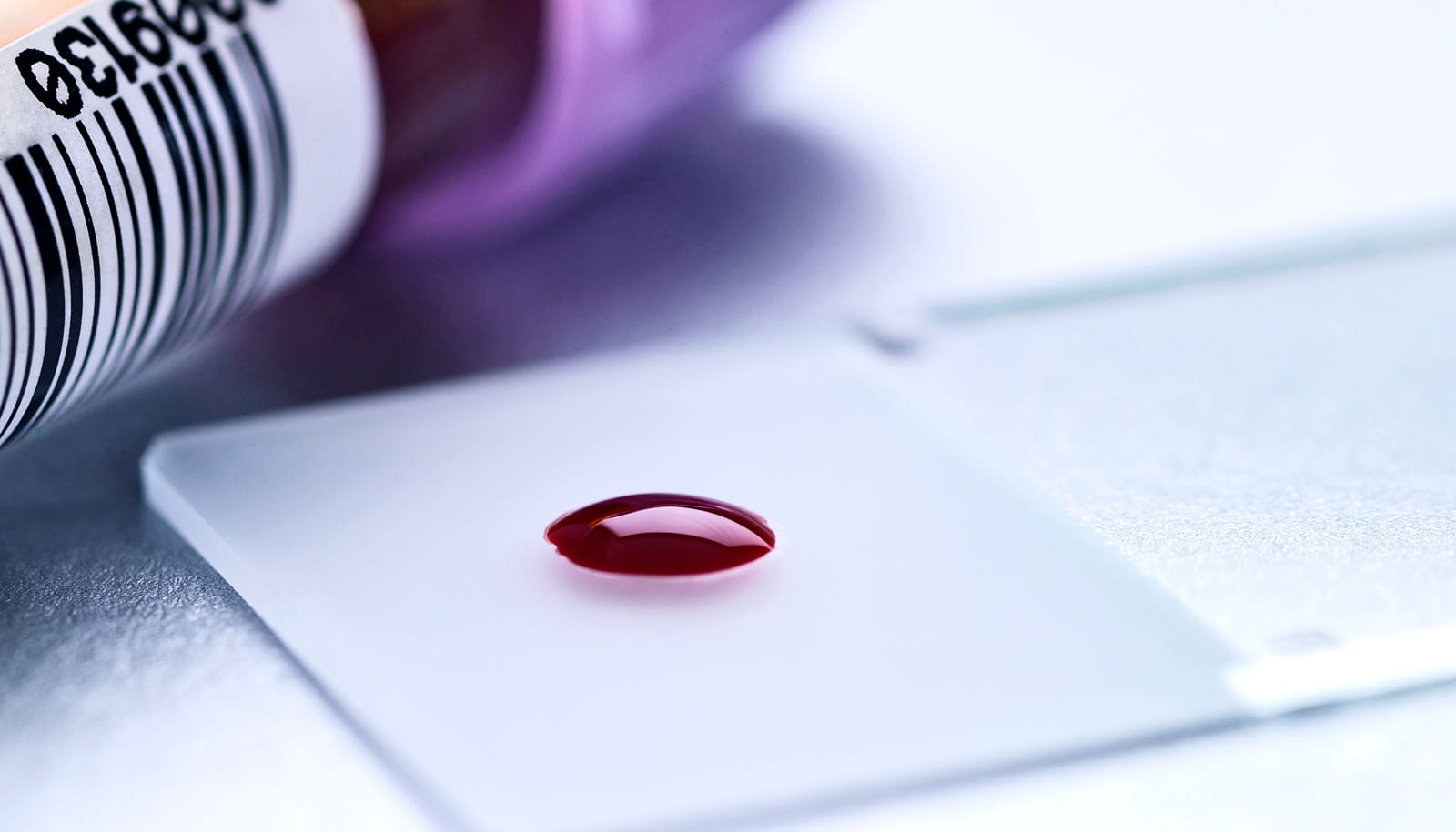 blood slide and vial (gene editing concept)