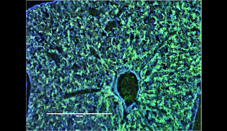 fetal mouse liver