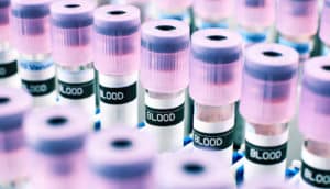 vials of blood - iron levels