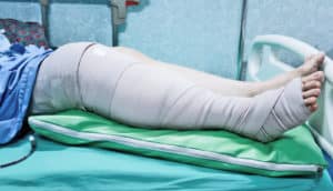 leg bandage, hospital bed