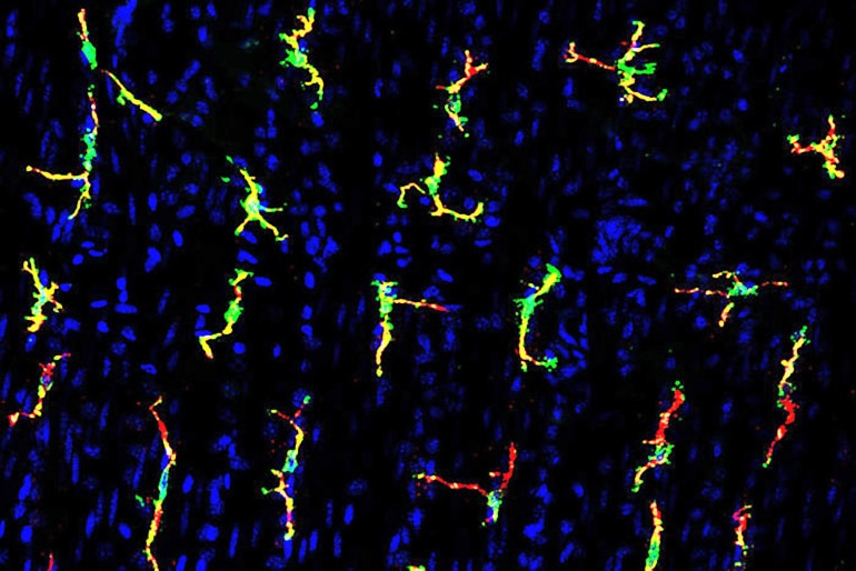 macrophages chemo gut issues