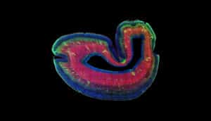 subplate of brain in green