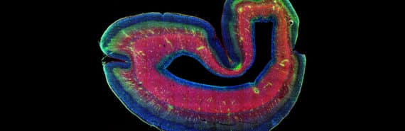 Healthy Stem Cells May Keep Aging Muscles Young Futurity
