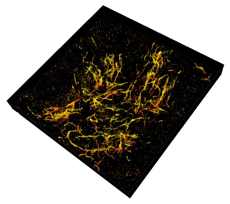 slice of mouse brain - yellow and orange tendrils on black