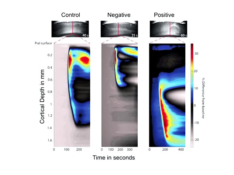 migraine comparison