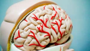 model of the brain - TBI