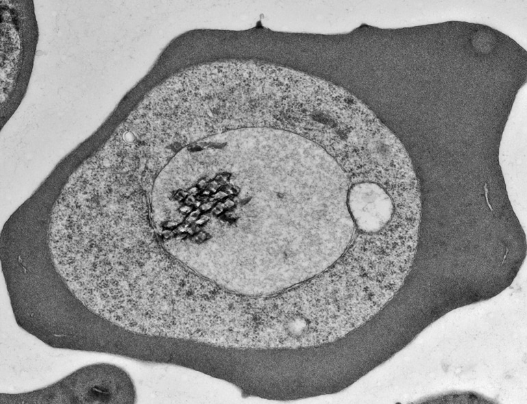 malaria hijacking blood cell