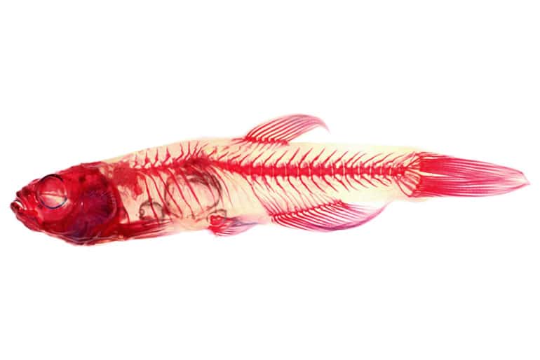 scoliosis zebrafish