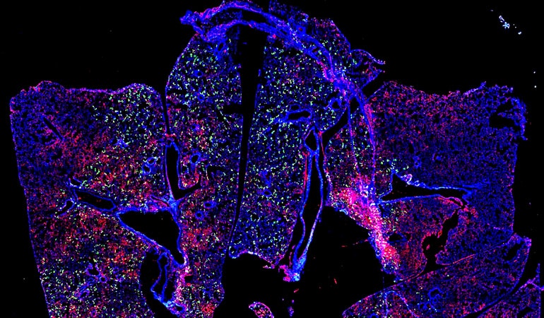 Image of RSV in a mouse lung.