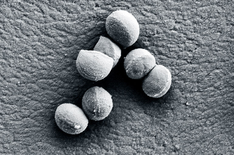 <em>Staphylococcus aureus</em> bacteria cells as they divide