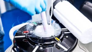 cryopreservation tank