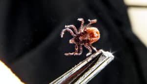 tick on tweezers
