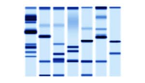 dna sequencing gel