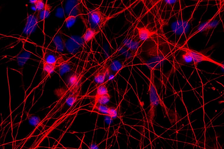 MAPT gene mutation