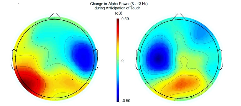 Scalp map showing brain activity right before a touch to the hand. 