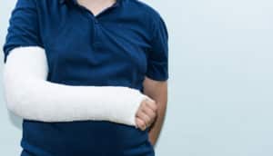 child with broken arm