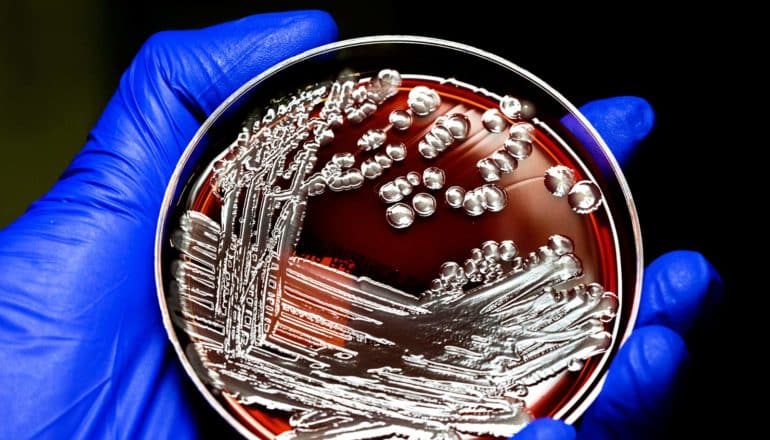blue gloved hand holds e coli in petri dish