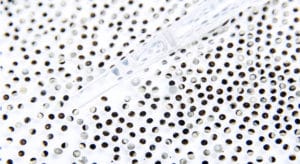 frog eggs