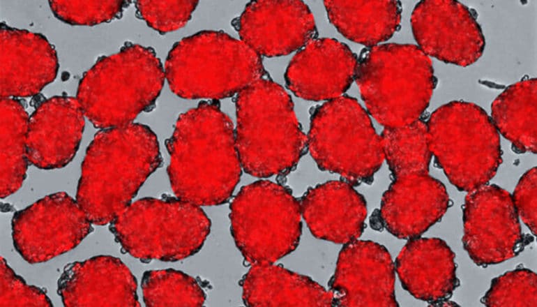 stem cells insulin