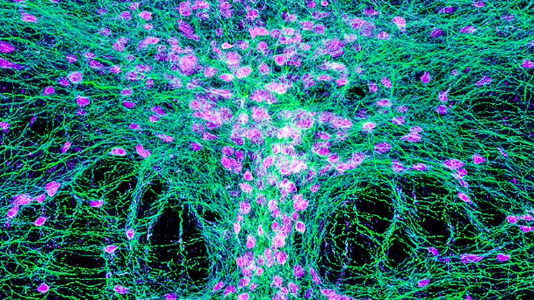 serotonin neurons