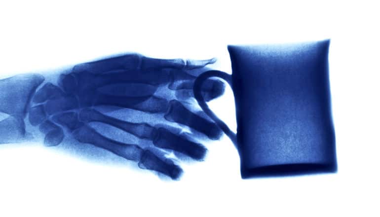 coffee cup hand x-ray (wrist bones concept)