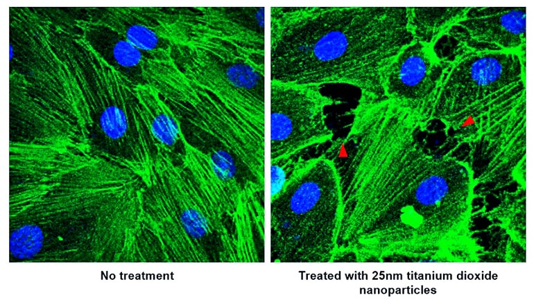 nanoparticles and blood vessels