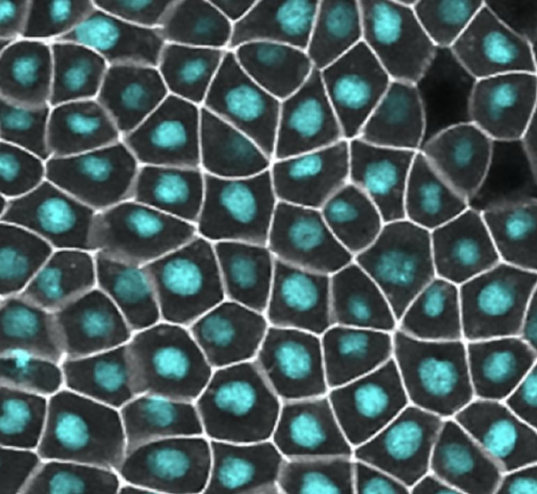 nuclei junctions