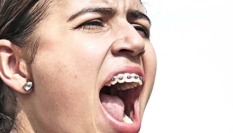 shouting teen girl with braces