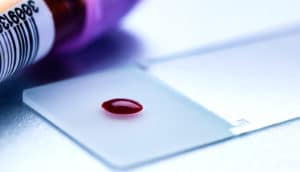 single drop of blood (lab-on-a-chip concept)