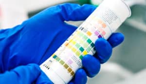 blue gloved hands hold urine test strips