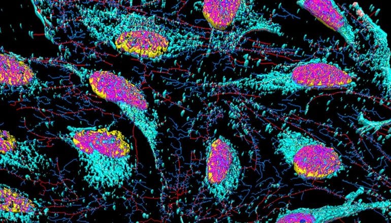 HeLA cells under microscope