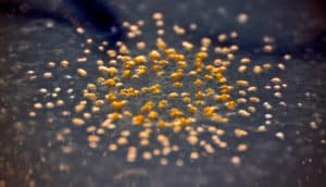 M. xanthus bacteria - gold dots on black