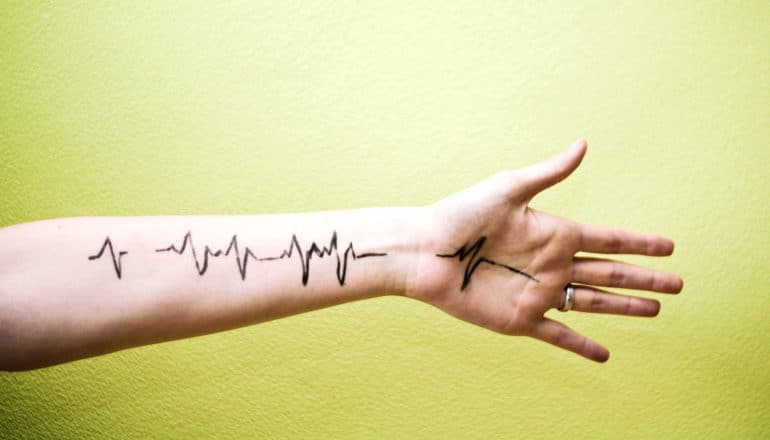 arm heartbeat monitor