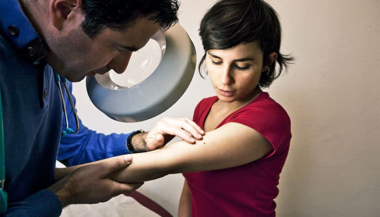 skin cancer check