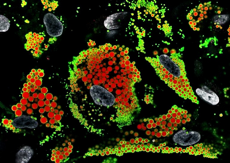 Immunofluorescence staining inside adipocyte